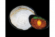 Egg Roast And 3 Appam